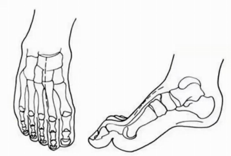 =webp&wxfrom=5&wx_lazy=1&wx_co=1