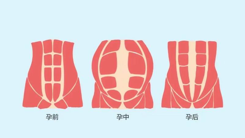 640_wx_fmt=png&from=appmsg&tp=webp&wxfrom=5&wx_lazy=1&wx_co=1