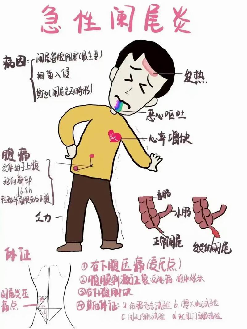 640_wx_fmt=png&from=appmsg&tp=webp&wxfrom=5&wx_lazy=1&wx_co=1 (1)_副本