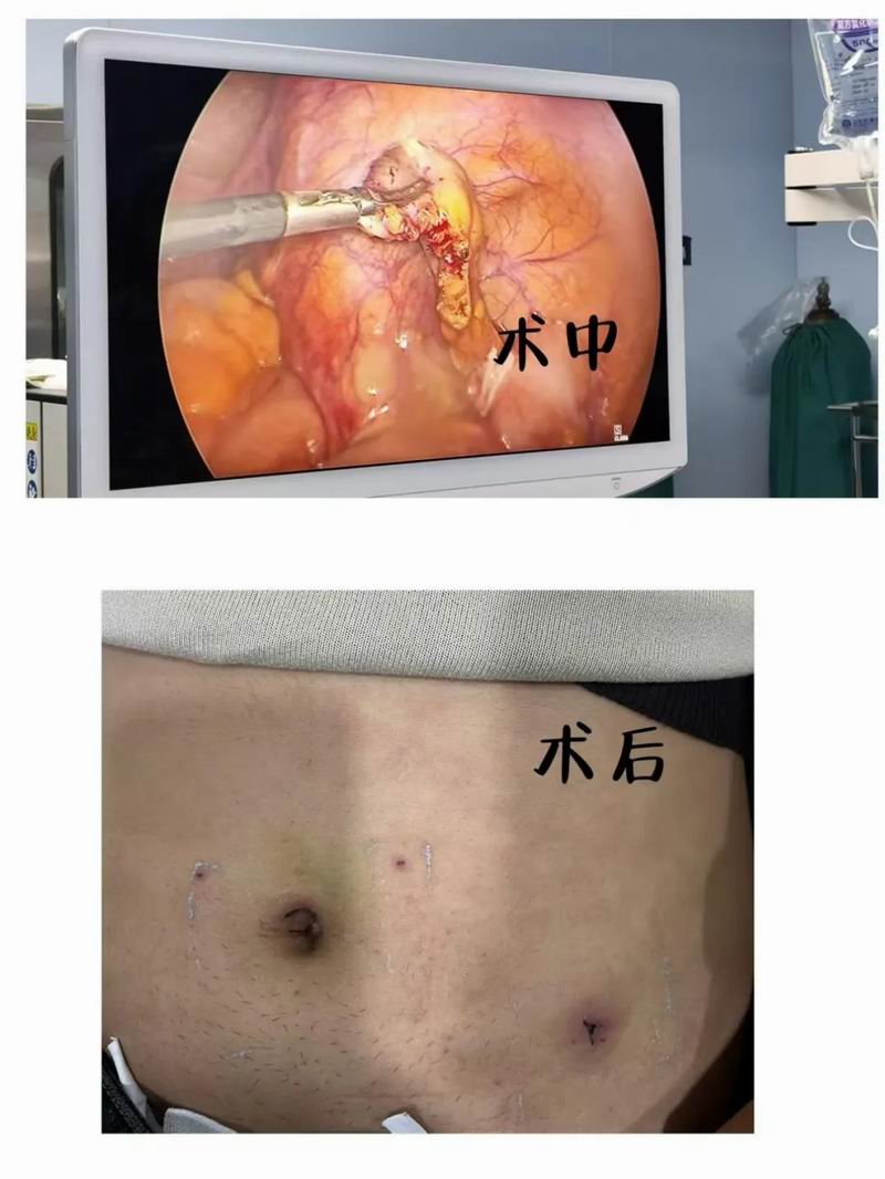 640_wx_fmt=png&from=appmsg&tp=webp&wxfrom=5&wx_lazy=1&wx_co=1 (2)_副本