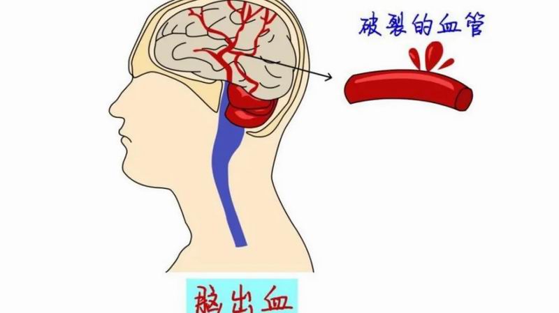 640_wx_fmt=png&from=appmsg&tp=webp&wxfrom=5&wx_lazy=1&wx_co=1 (22)