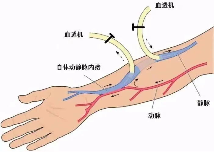 640_wx_fmt=png&from=appmsg&tp=webp&wxfrom=5&wx_lazy=1&wx_co=1