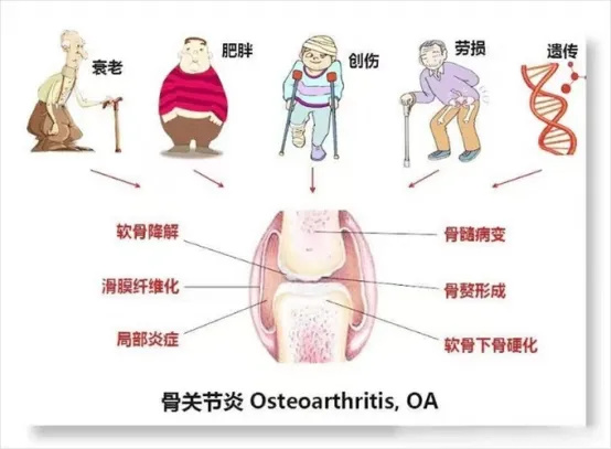 640_wx_fmt=png&from=appmsg&tp=webp&wxfrom=5&wx_lazy=1&wx_co=1