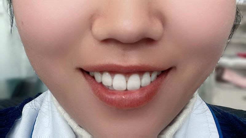 640_wx_fmt=png&from=appmsg&tp=webp&wxfrom=5&wx_lazy=1 (2)