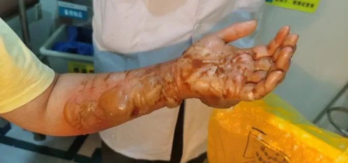 640_wx_fmt=png&from=appmsg&tp=webp&wxfrom=5&wx_lazy=1 (10)