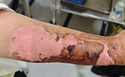 640_wx_fmt=png&from=appmsg&tp=webp&wxfrom=5&wx_lazy=1 (13)