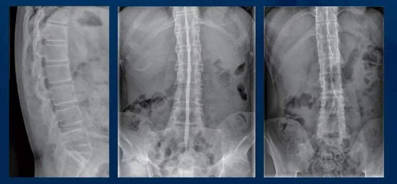 640_wx_fmt=png&from=appmsg&tp=webp&wxfrom=5&wx_lazy=1 (35)