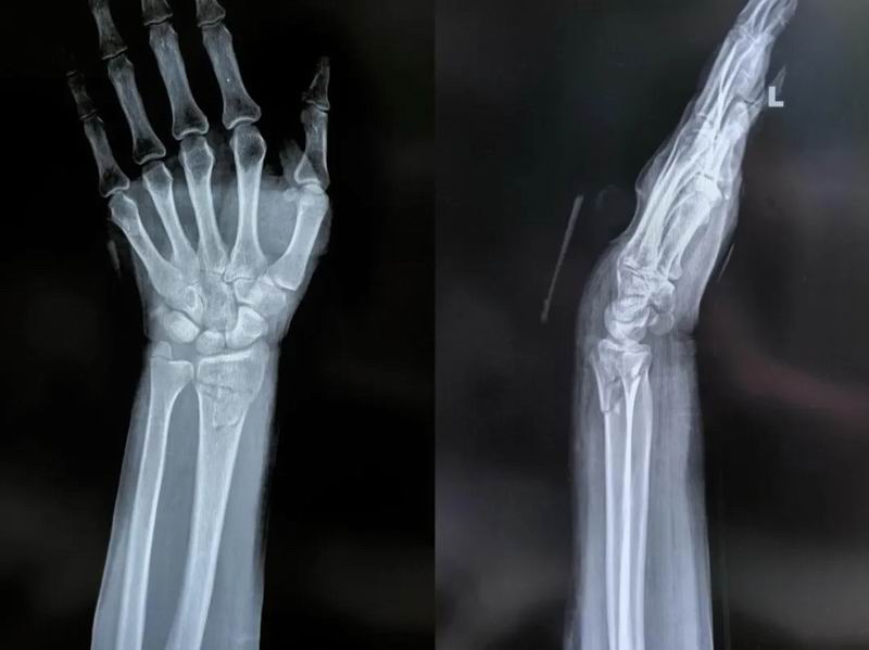 640_wx_fmt=png&from=appmsg&tp=webp&wxfrom=5&wx_lazy=1 (13)